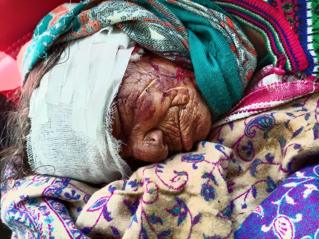 60 वर्षीय वृद्धा को जंगली सुअरों ने किया लहूलुहान,हायर सेंटर रेफर
